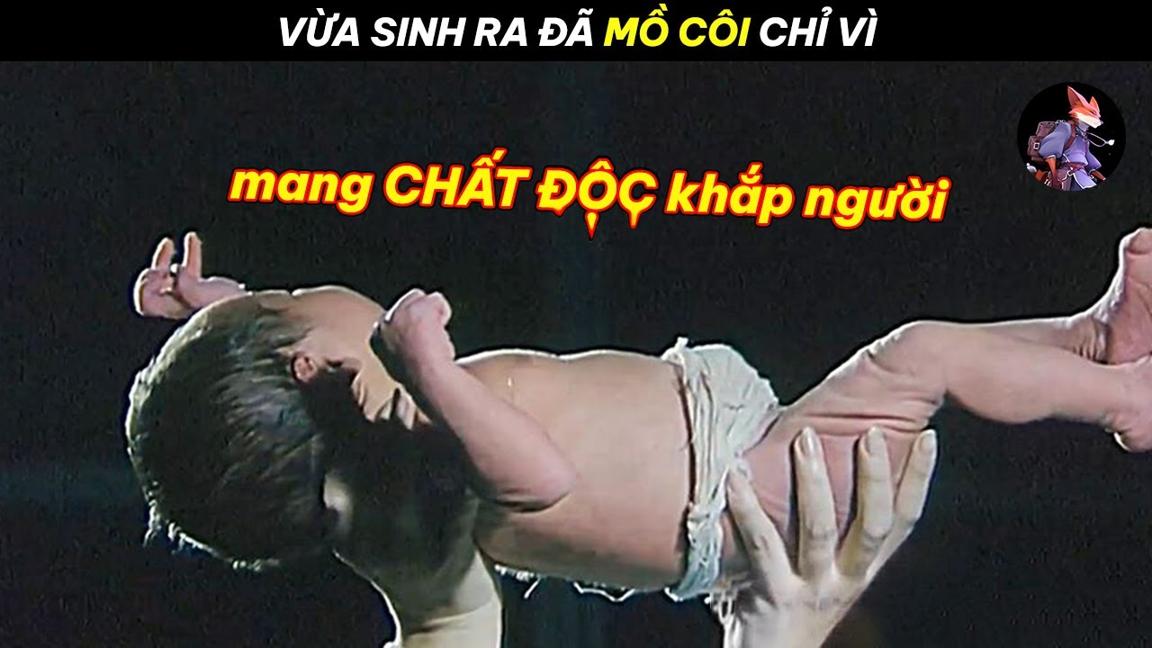 Cậu Bé Vừa Sinh Ra Đã Mang Chất Đ.ộc Khắp Cơ Thể |Fox Review|