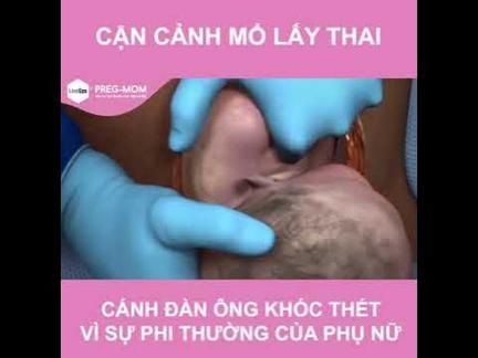 Cận cảnh quá trình mổ lấy thai, đàn ông xem đều khóc thết