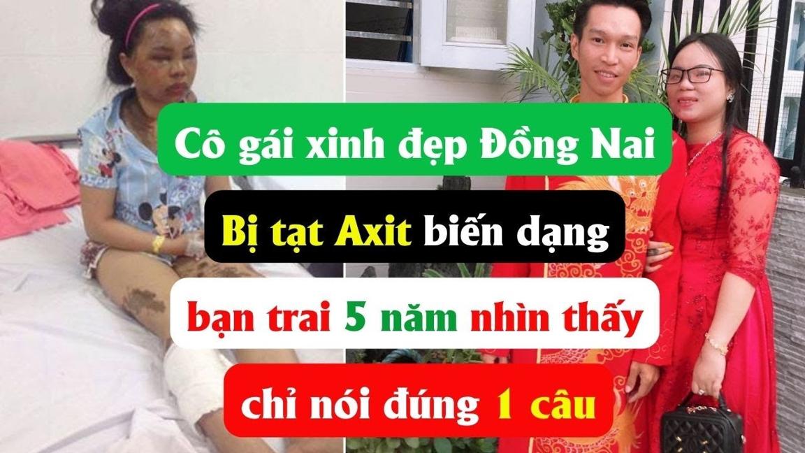 Cô gái xinh đẹp Đồng Nai bị tạt axit biến dạng, bạn trai 5 năm nhìn thấy chỉ nói đúng 1 câu